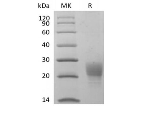 Recombinant Cynomolgus PVRIG (C-6His) - ABMIUM