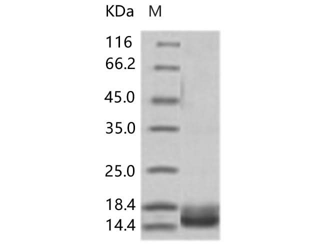 Recombinant WNV (lineage 2, strain Nea Santa-Greece-2010) E / Envelope Protein (Domain III, His Tag) - ABMIUM