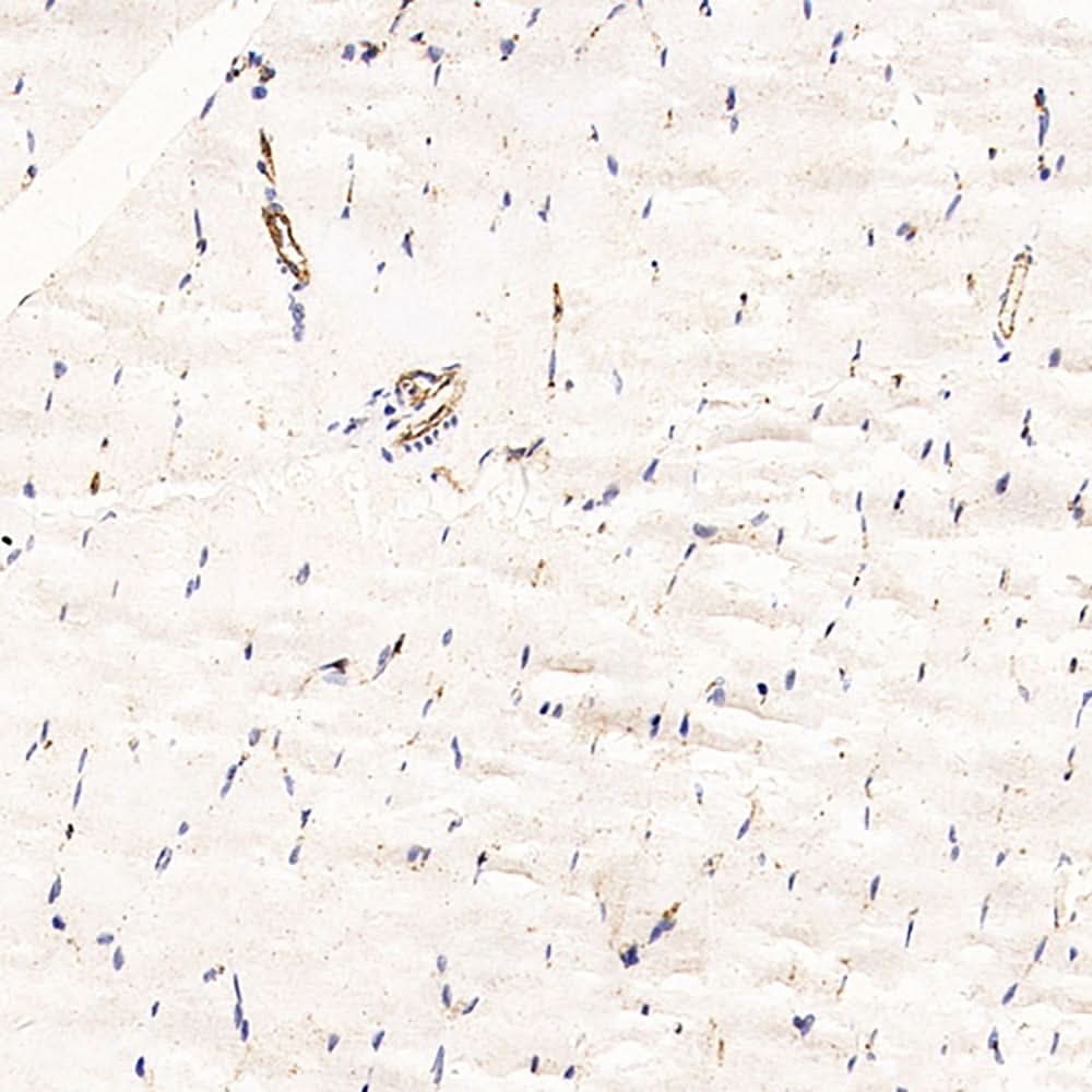 Immunohistochemistry analysis of paraffin-embedded Rat skeletal muscle using CD31 Monoclonal Antibody at dilution of 1:200.