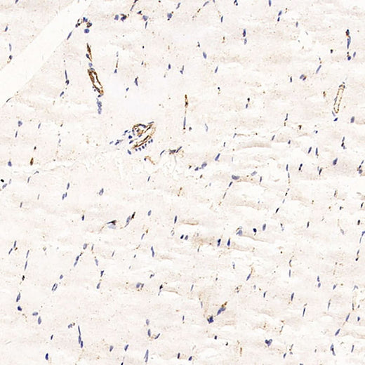 Immunohistochemistry analysis of paraffin-embedded Rat skeletal muscle using CD31 Monoclonal Antibody at dilution of 1:200.