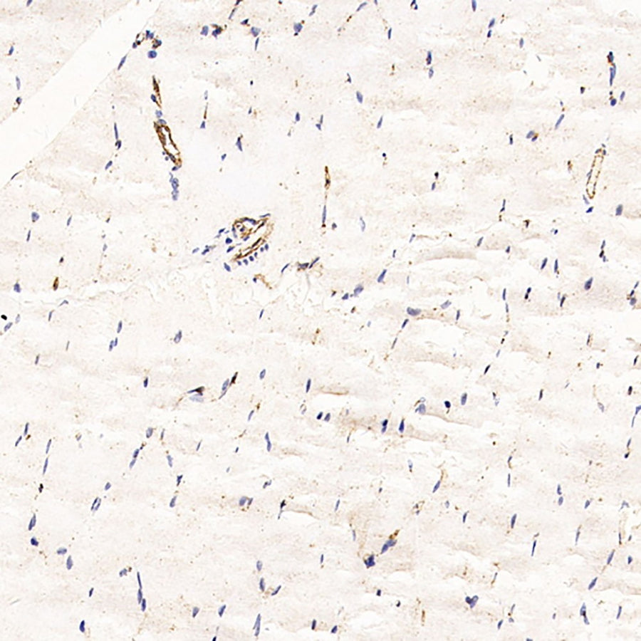 Immunohistochemistry analysis of paraffin-embedded Rat skeletal muscle using CD31 Monoclonal Antibody at dilution of 1:200.