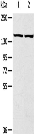 Anti-Human/Mouse TBC1D4 Antibody - ABMIUM