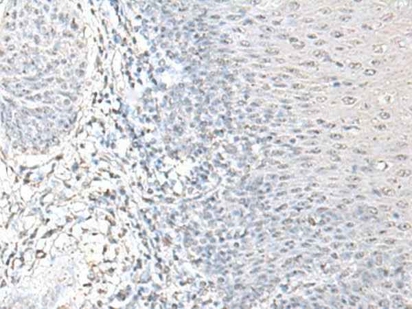 Anti-Human/Mouse/Rat EPM2A Antibody