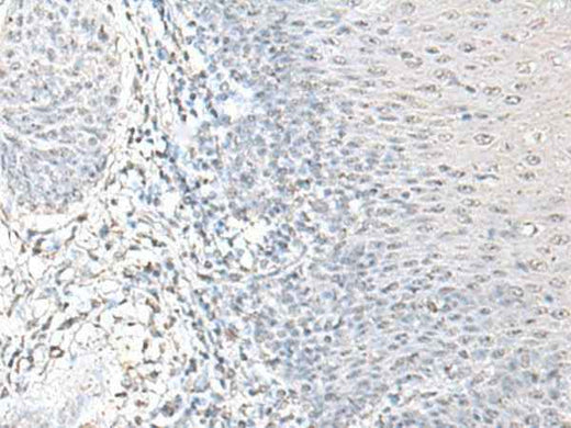 Anti-Human/Mouse/Rat EPM2A Antibody