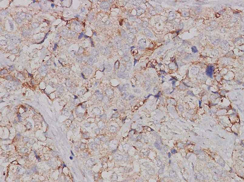 Anti-Human JAK1 Antibody - ABMIUM