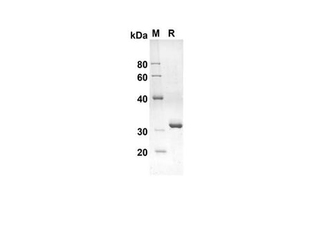 SDS-PAGE analysis of Rat I-PTH proteins, 2 μg/lane of Recombinant Rat I-PTH proteins was resolved with an SDS-PAGE under reducing conditions, showing bands at 29.1 kDa.