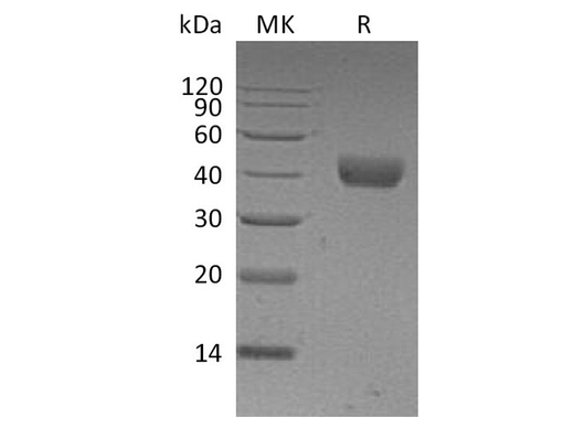Recombinant Human CD38 Protein (His Tag) - ABMIUM