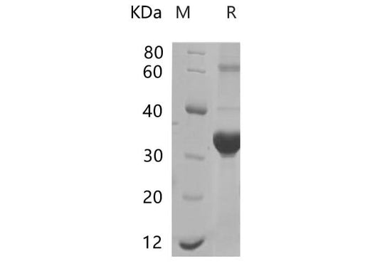 SDS-PAGE analysis of Mouse IFNAR1 proteins, 2 μg/lane of Recombinant Mouse IFNAR1 proteins was resolved with SDS-PAGE under reducing conditions, showing bands at 31.66 kDa.