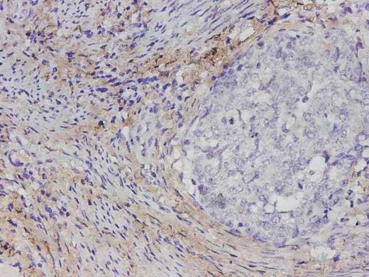 Anti-Human COL1A1 Antibody