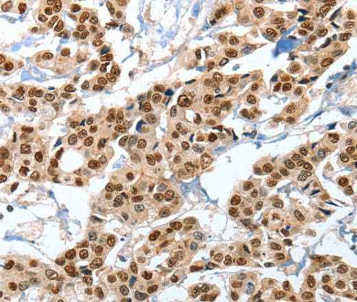 Anti-Human/Mouse ANXA10 Antibody