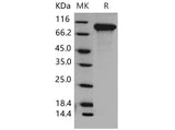 Recombinant Mouse DDR2 Kinase/CD167b Protein (His Tag) - ABMIUM
