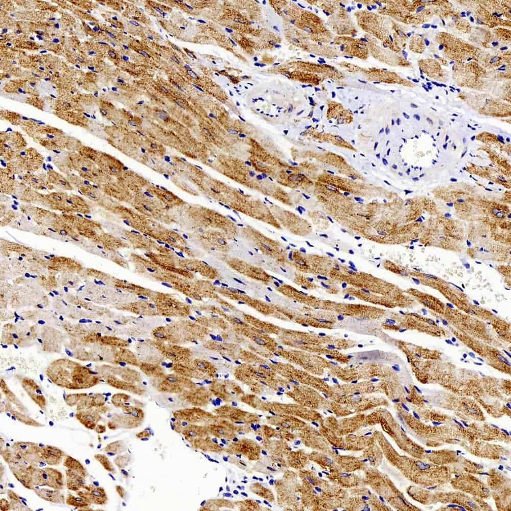 Immunohistochemistry analysis of paraffin-embedded mouse skeletal muscle using GLUT-4 Polyclonal Antibody at dilution of 1:500.