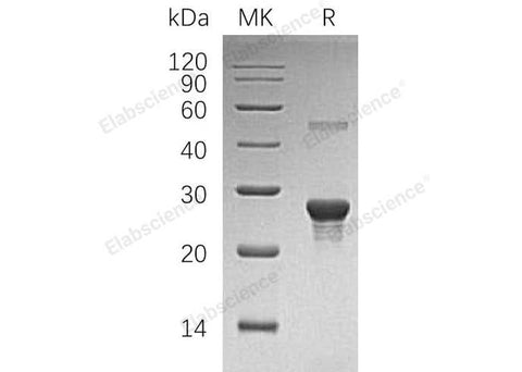 Recombinant Human PPCDC Protein (His Tag) - ABMIUM