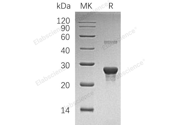 Recombinant Human PPCDC Protein (His Tag) - ABMIUM