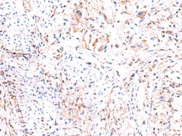Anti-Human/Mouse/Rat PHKG2 Antibody