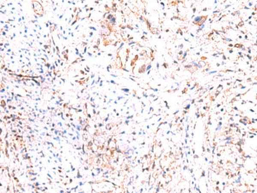 Anti-Human/Mouse/Rat PHKG2 Antibody