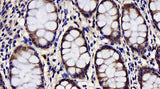 Immunohistochemistry analysis of paraffin-embedded human colon using CHOP Polyclonal Antibody at dilution of 1:300.