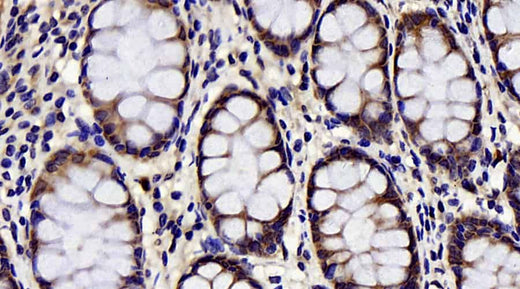 Immunohistochemistry analysis of paraffin-embedded human colon using CHOP Polyclonal Antibody at dilution of 1:300.