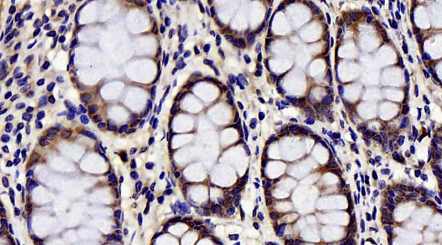 Immunohistochemistry analysis of paraffin-embedded human colon using CHOP Polyclonal Antibody at dilution of 1:300.