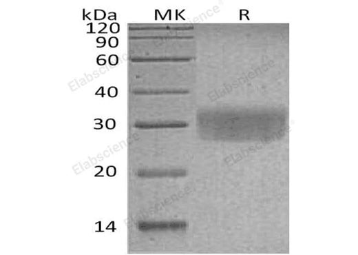 Recombinant Human CD7/GP40 Protein (His Tag) - ABMIUM