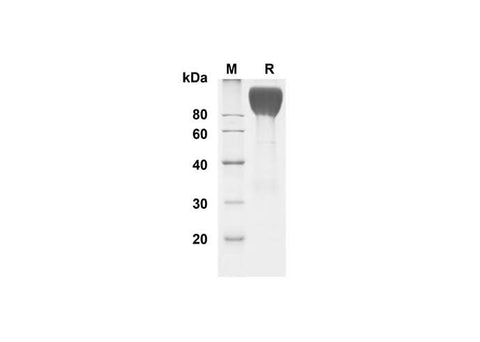 SDS-PAGE analysis of Human CEACAM-1/CD66a proteins , 2 μg/lane of Recombinant Human CEACAM-1/CD66a proteins was resolved with SDS-PAGE under reducing conditions , showing bands at 90-100 kDa.
