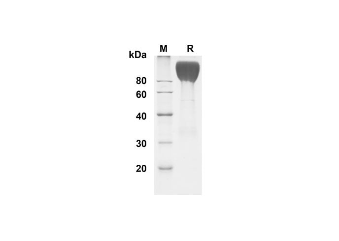 SDS-PAGE analysis of Human CEACAM-1/CD66a proteins , 2 μg/lane of Recombinant Human CEACAM-1/CD66a proteins was resolved with SDS-PAGE under reducing conditions , showing bands at 90-100 kDa.