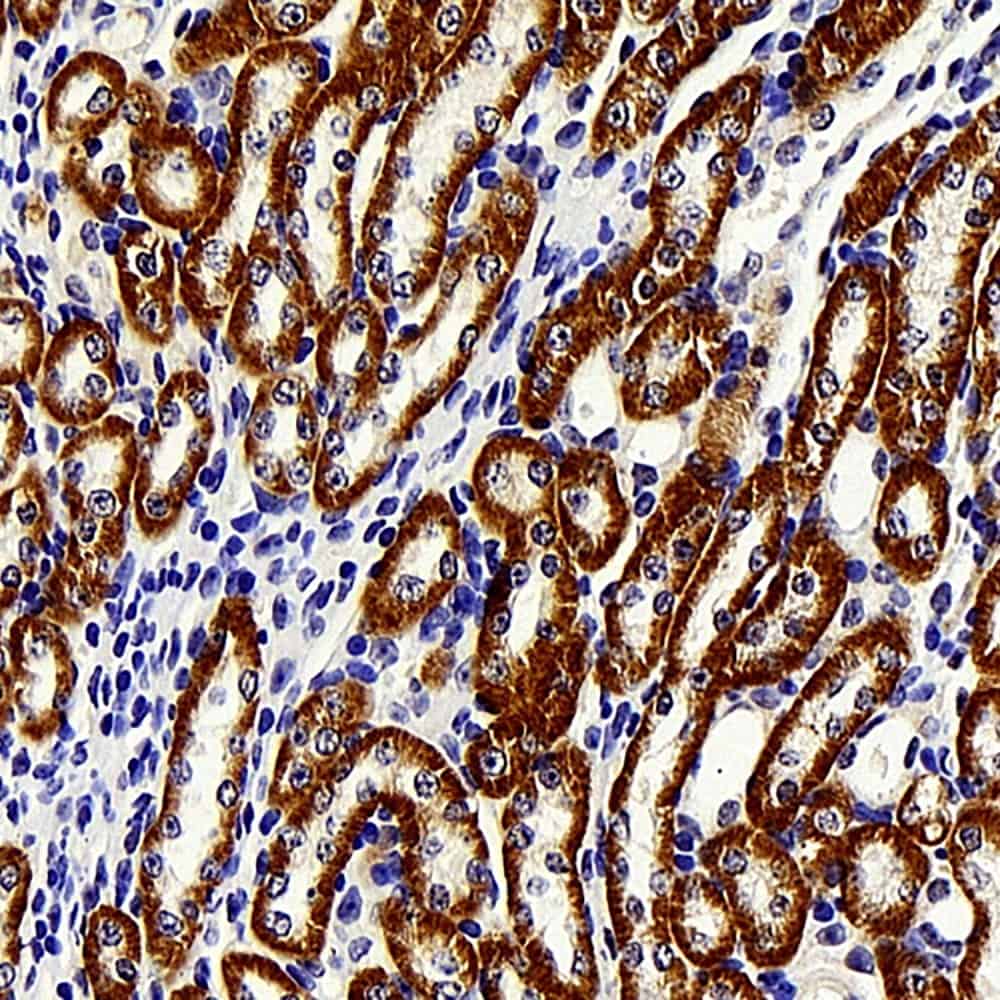 Immunohistochemistry analysis of paraffin-embedded mouse kidney using BRAF Polyclonal Antibody at dilution of 1:400.
