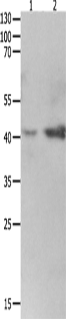 Anti-Human/Mouse/Rat LRPAP1 Antibody - ABMIUM