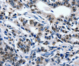 Anti-Human/Mouse/Rat ENPP3 Antibody - ABMIUM