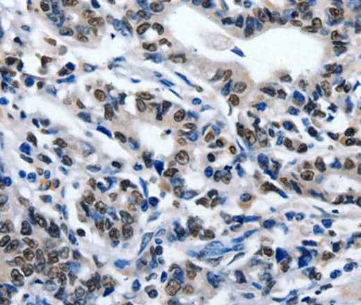 Anti-Human/Mouse/Rat ENPP3 Antibody
