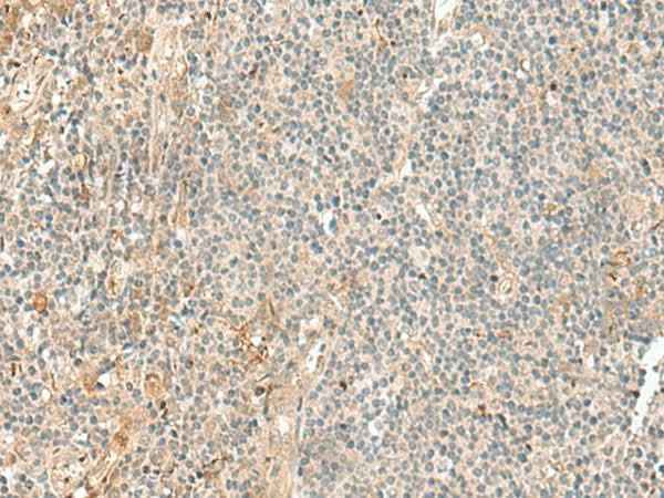 Anti-Human/Mouse/Rat NGEF Antibody