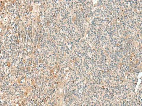 Immunohistochemistry of paraffin-embedded Human tonsil tissue using NGEF Polyclonal Antibody at dilution of 1:35(×200)