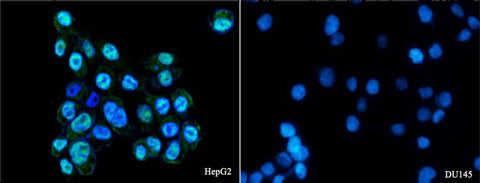 Anti-Human AR Antibody [A1006] - ABMIUM