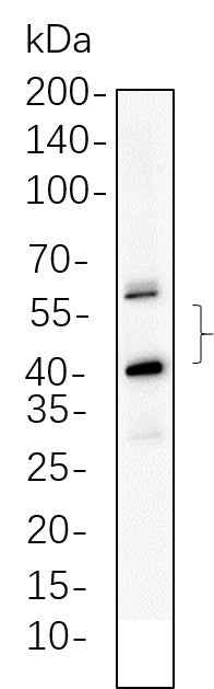 Anti-Human/Mouse/Rat JNK2 Antibody [B546] - ABMIUM