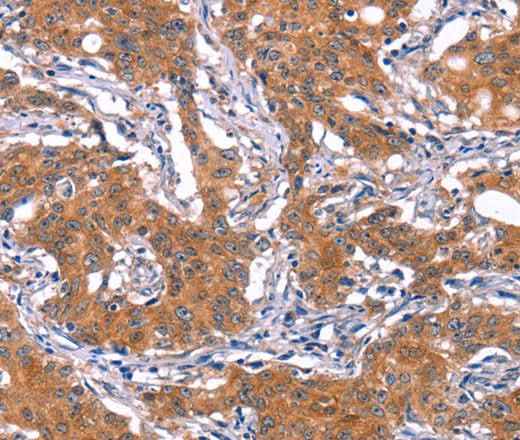 Anti-Human/Mouse/Rat IRS1 Antibody