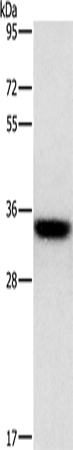 Anti-Human/Mouse HOXB13 Antibody - ABMIUM