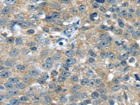 Anti-Human PBOV1 Antibody - ABMIUM