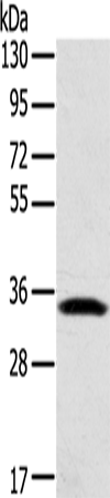 Anti-Human/Mouse STX11 Antibody - ABMIUM