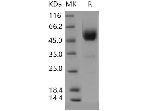 Recombinant Human SIGIRR/TIR8 Protein (Fc Tag) - ABMIUM