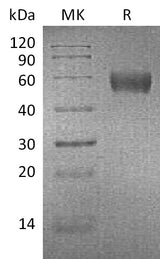 Recombinant Mouse Apolipoprotein H/ApoH Protein (His Tag) - ABMIUM