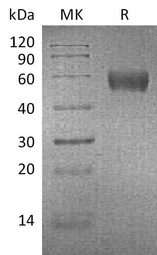 Recombinant Mouse Apolipoprotein H/ApoH Protein (His Tag) - ABMIUM