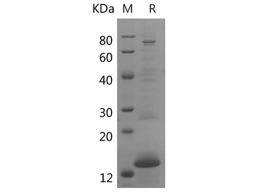 SDS-PAGE analysis of Rat NEFL proteins, 2 μg/lane of Recombinant Rat NEFL proteins was resolved with SDS-PAGE under reducing conditions, showing bands at 13 kDa.
