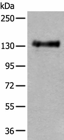 Western blot analysis of Mouse brain tissue lysate using PTPRA Polyclonal Antibody at dilution of 1:400