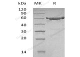 Recombinant Human KPNA2 Protein (His Tag) - ABMIUM