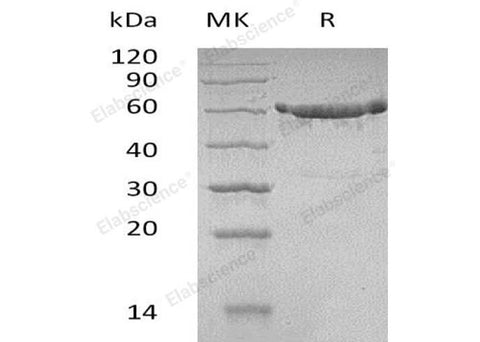 Recombinant Human KPNA2 Protein (His Tag) - ABMIUM