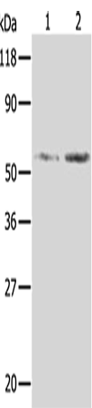 Anti-Human/Mouse/Rat AKR1B1 Antibody - ABMIUM