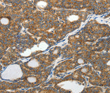 Anti-Human/Mouse/Rat SLC12A4 Antibody - ABMIUM