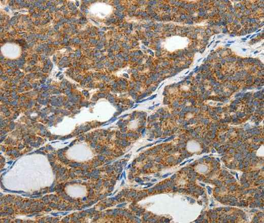 Anti-Human/Mouse/Rat SLC12A4 Antibody