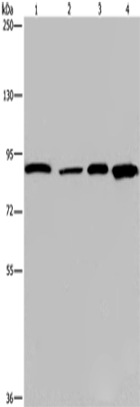 Anti-Human/Mouse/Rat JUP Antibody - ABMIUM