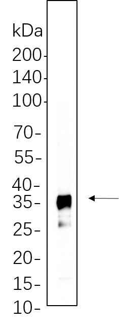 Anti-Human/Mouse/Rat/Pig IκB-α Antibody [B625] - ABMIUM